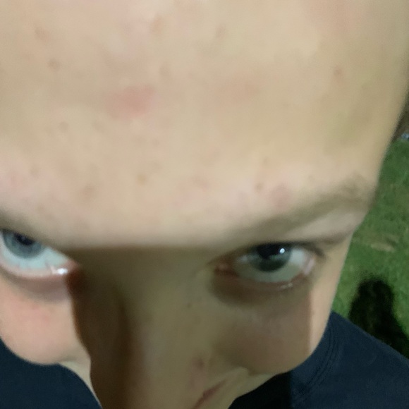nhorto1